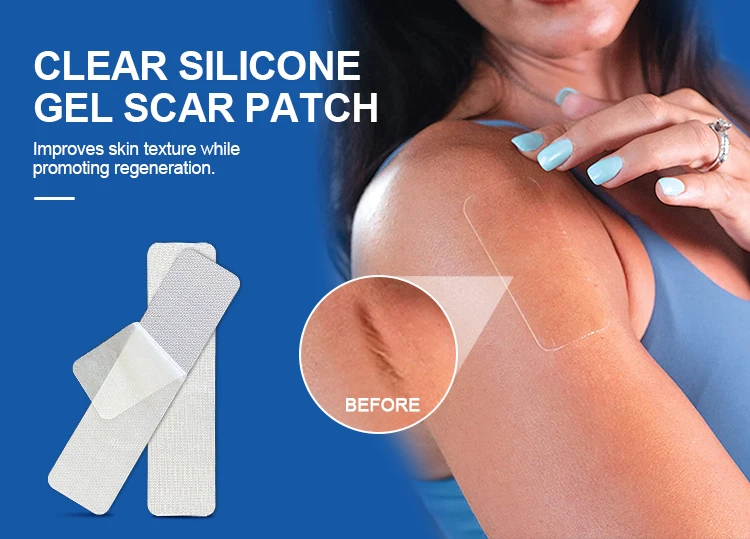 Factory Hot Sales Medical Gradetransparent Scar Removal Silicone Gel Patches Scar Removal Patch
