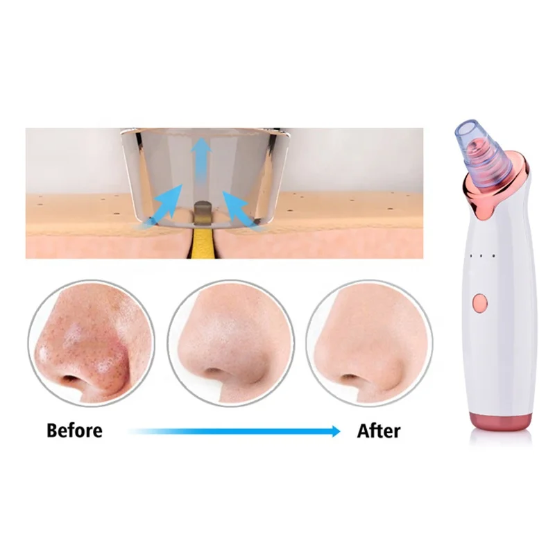 Electric Facial Nose Pores Cleaner Blackhead Vacuum Rechargeable Blackhead Remover Vacuum Pore Cleaner