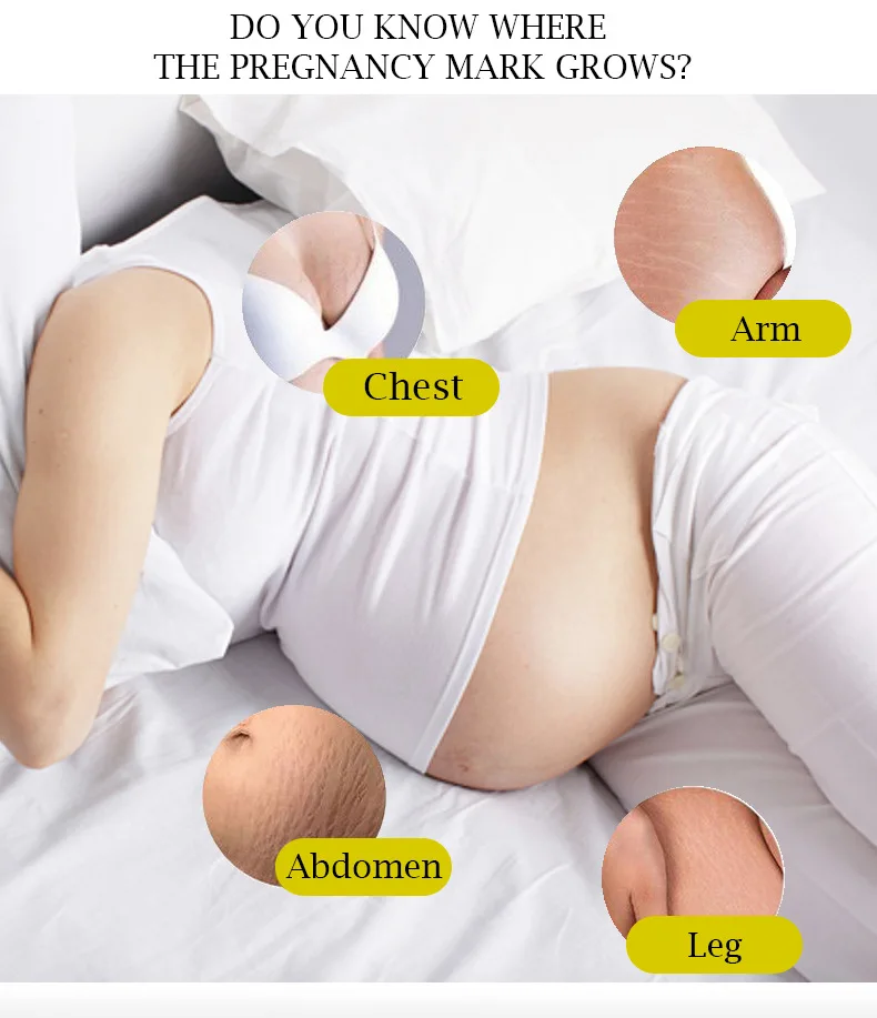 Natural Organic Stretch Mark Remove Cream Skin Repair Anti Vergeture For Pregnancy Scar Marks