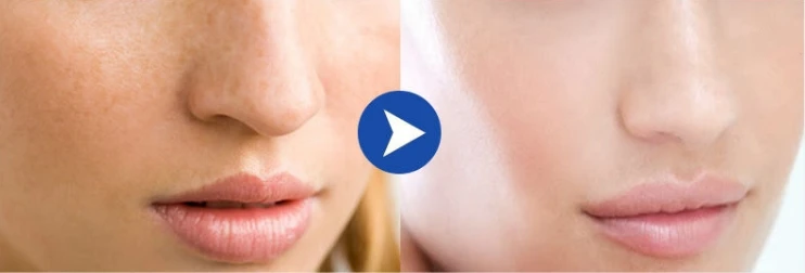  Goat Milk Skin Whitening and Bleaching Body