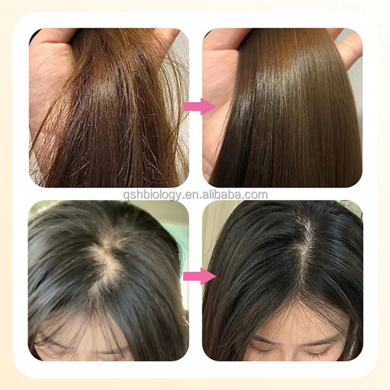 100% Natural Organic Cold Pressed Jamaican Black Castor Oil - Pure Unrefined Oils For Thickening Hair,Eyelashes,Eyebrows