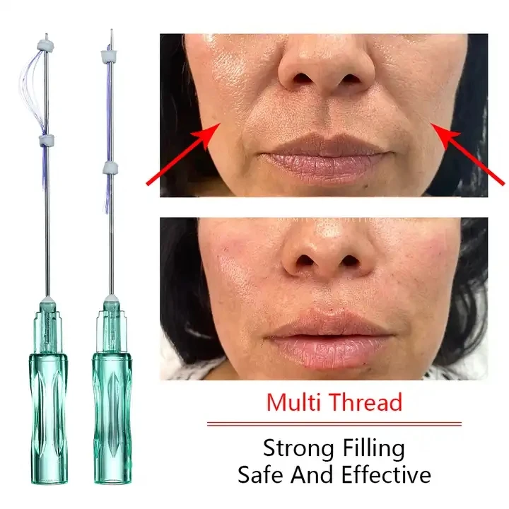 PDO hilos tensores face lift 21G38 21G 60 multi threads pcl multi threads