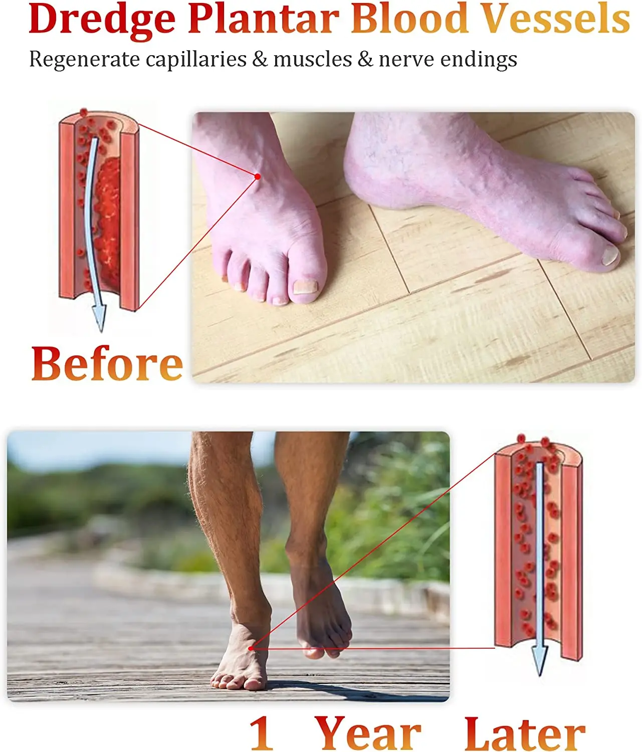 Hot Sell Unisex Therapist Shoes Handmade Wood Reflexology Acupressure Foot Massage Slipper
