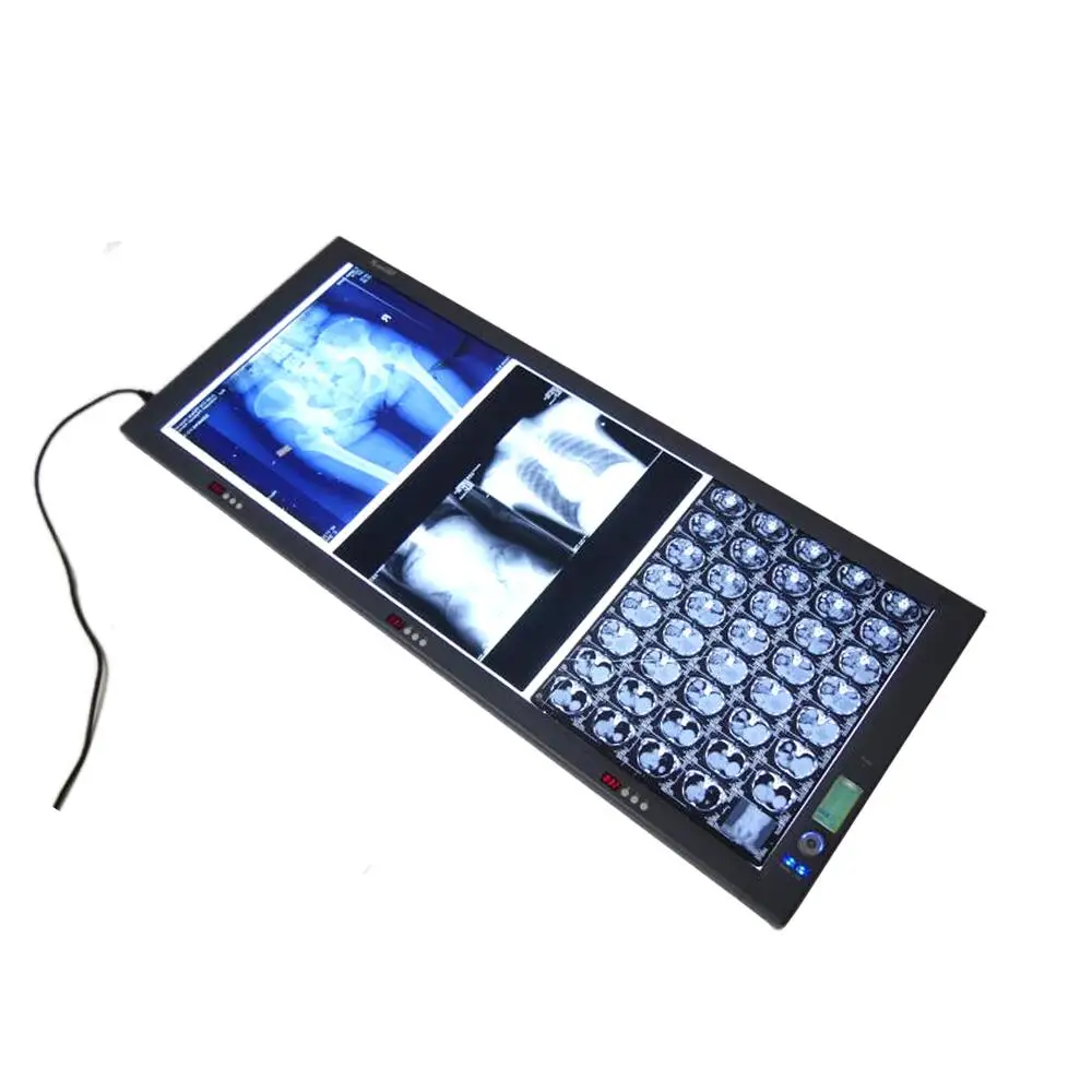 Medical  X Ray Film Viewer Negatoscope Three Panels Triple film xray view box
