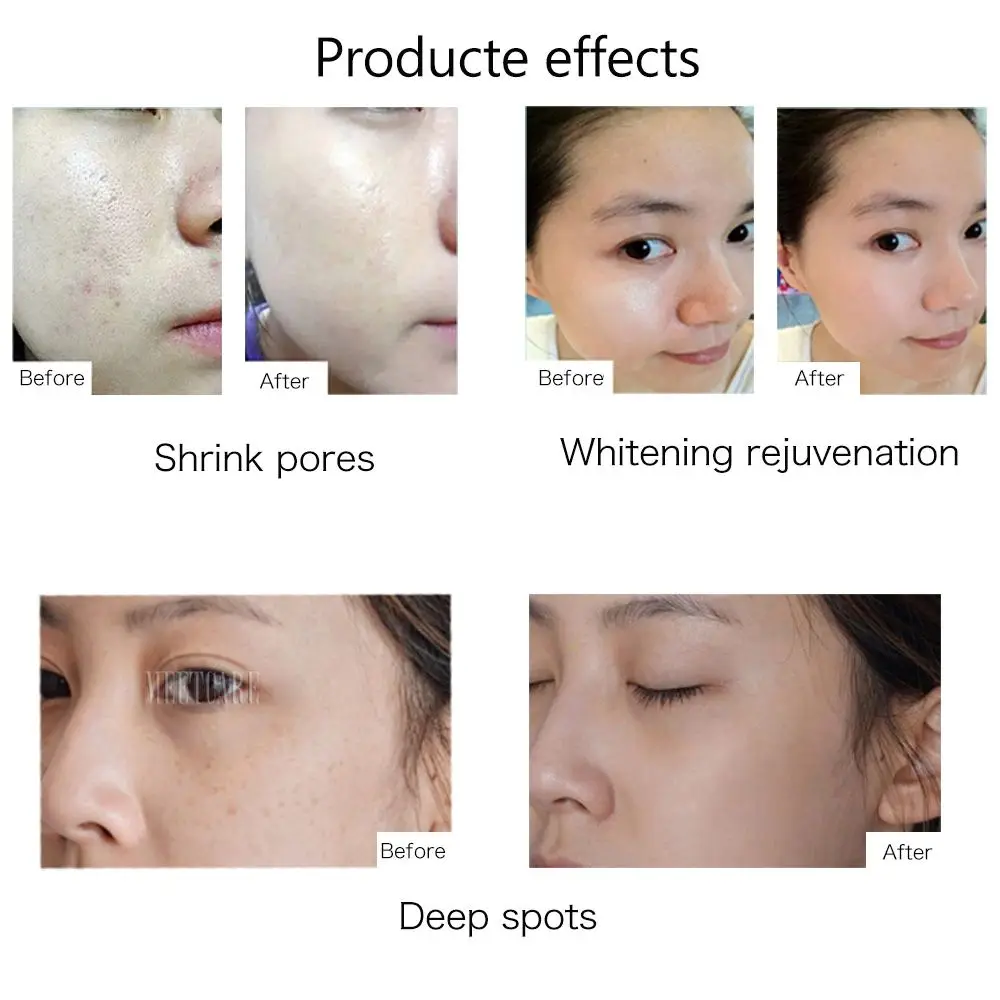 professional electric micro needle derma pen microneedling dermapen