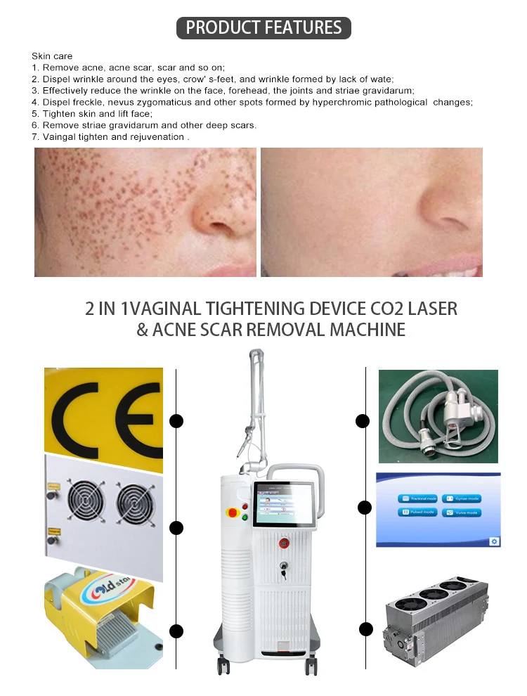 50% Off Co2 Fractional 100W Co2 Laser 9060 10600nm For Skin Whitening