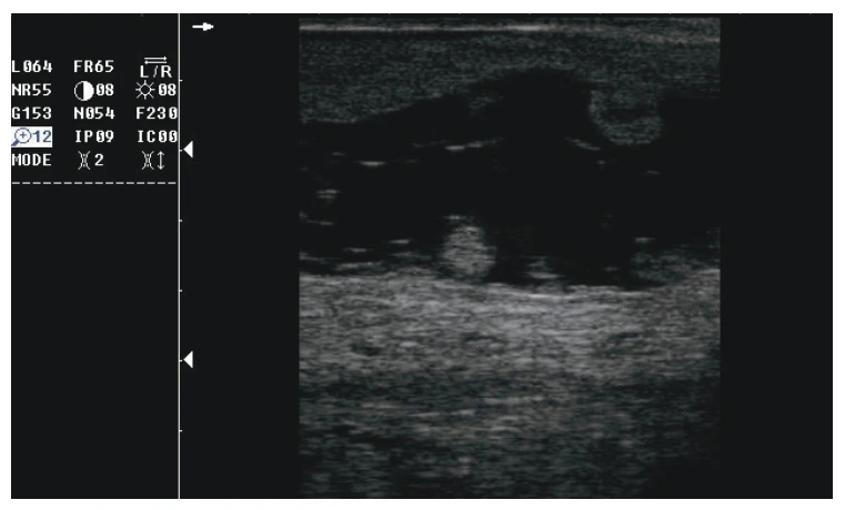 THR-V51A Low Price Handheld Veterinary Ultrasound Machine Animal Ultrasonic Diagnosis System