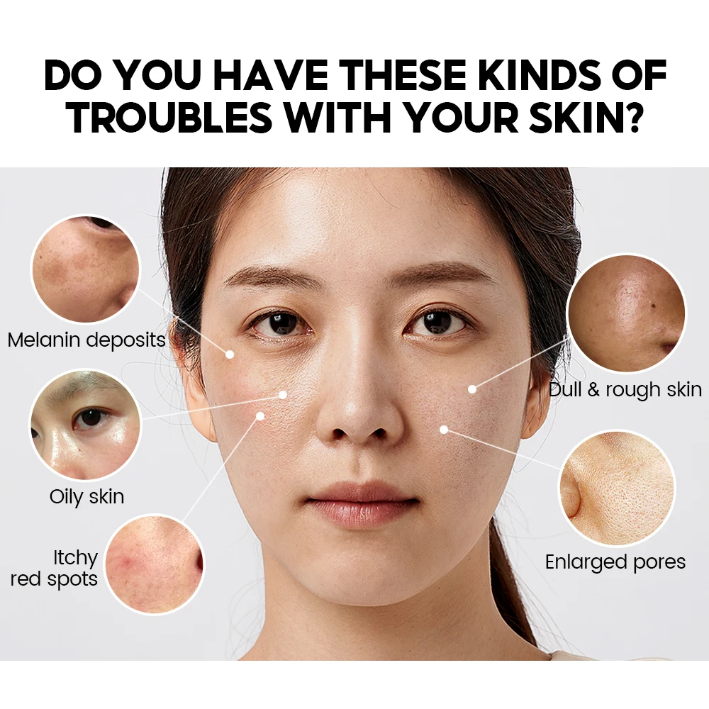 VIBRANT GLAMOUR Face Body Cleansing Niacinamide Brightening Soap Deep Cleansing Exfoliator Facial Cleanser