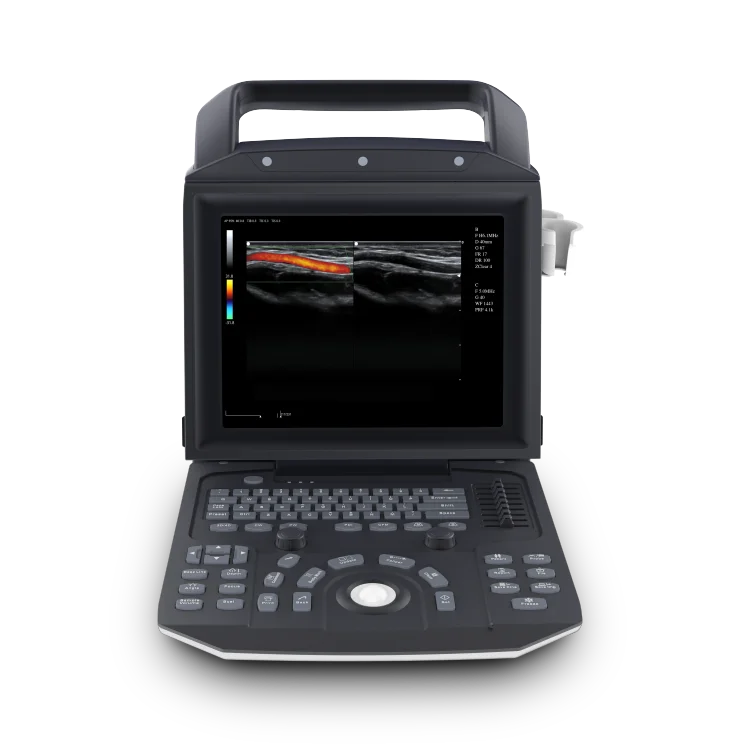 Veterinary Ultrasound Scanner China Handheld Full Color Ultrasound Machine Scanner Price Portable  Ultrasonic Diagnostic System