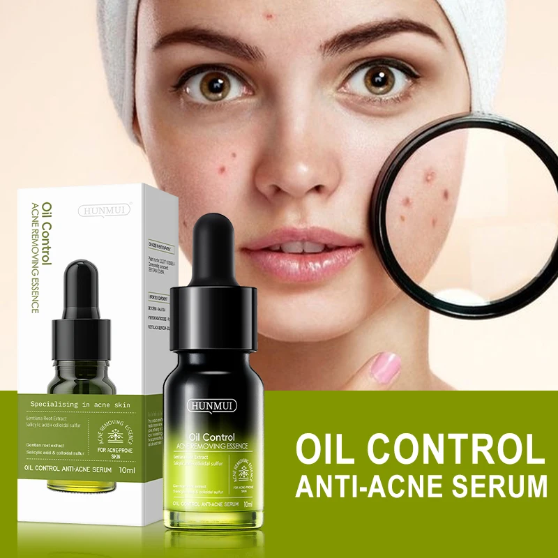 Hunmui Oil Control Acne Treatment Essence with Salicylic Acid & Sulfur