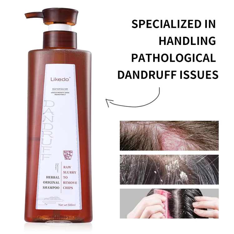 Customization Private Label for Anti-dandruff Problem High Treatment Scalp Problem Effective Anti-dandruff Hair Shampoo