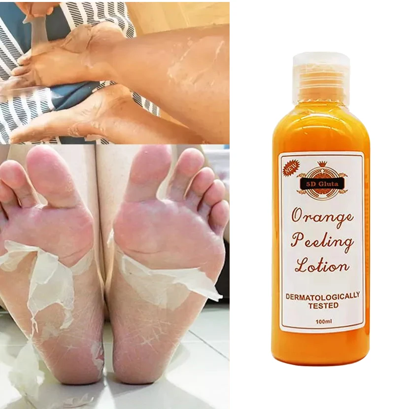 Custom Remove Dead Skin Exfoliating Face Orange Body Lotion Peeling for Lightening Whitening Exfoliating