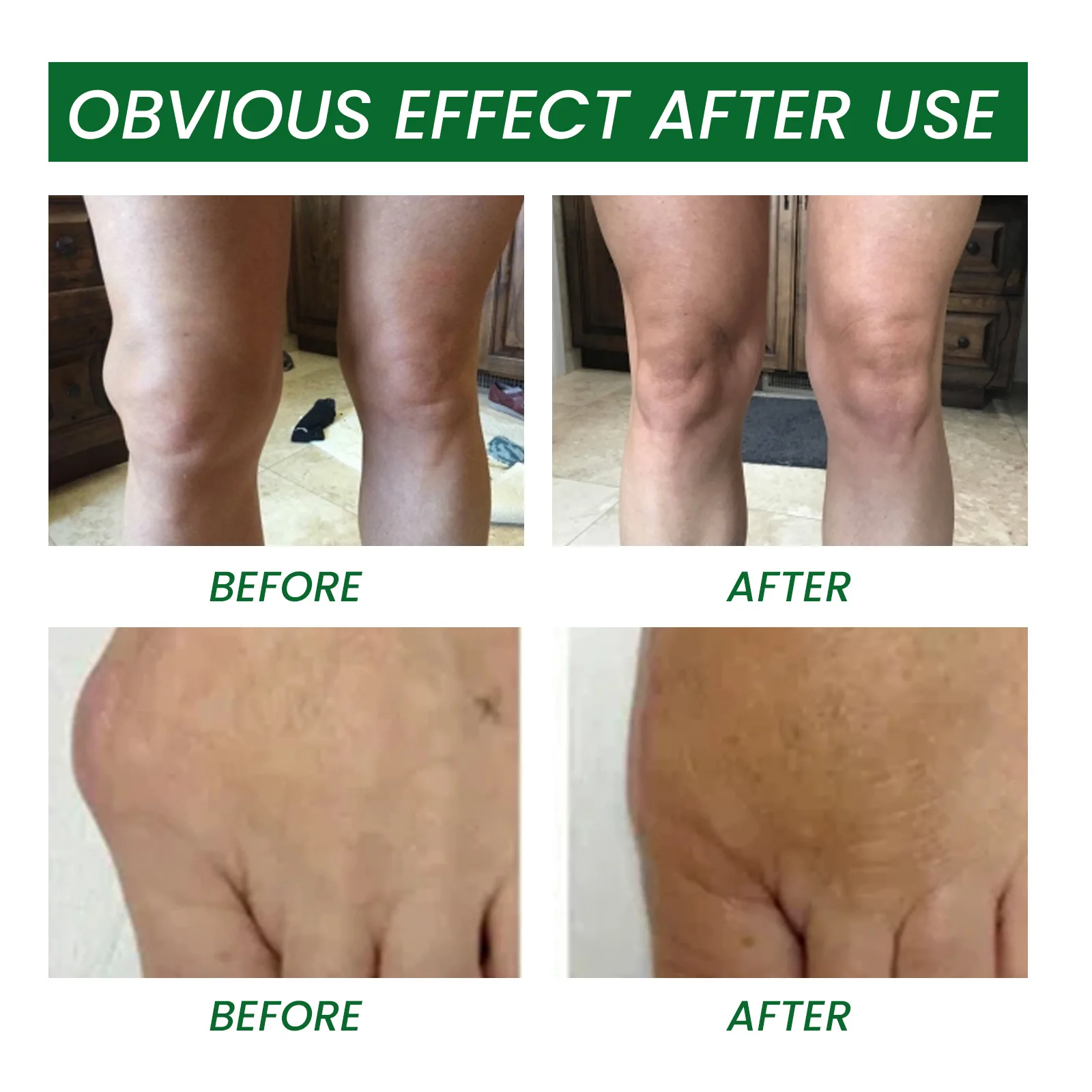 EELHOE Natural Herbal Extract bone Joint Shoulder Neck Pain Relieve Body Care Ointment Body Massage gel