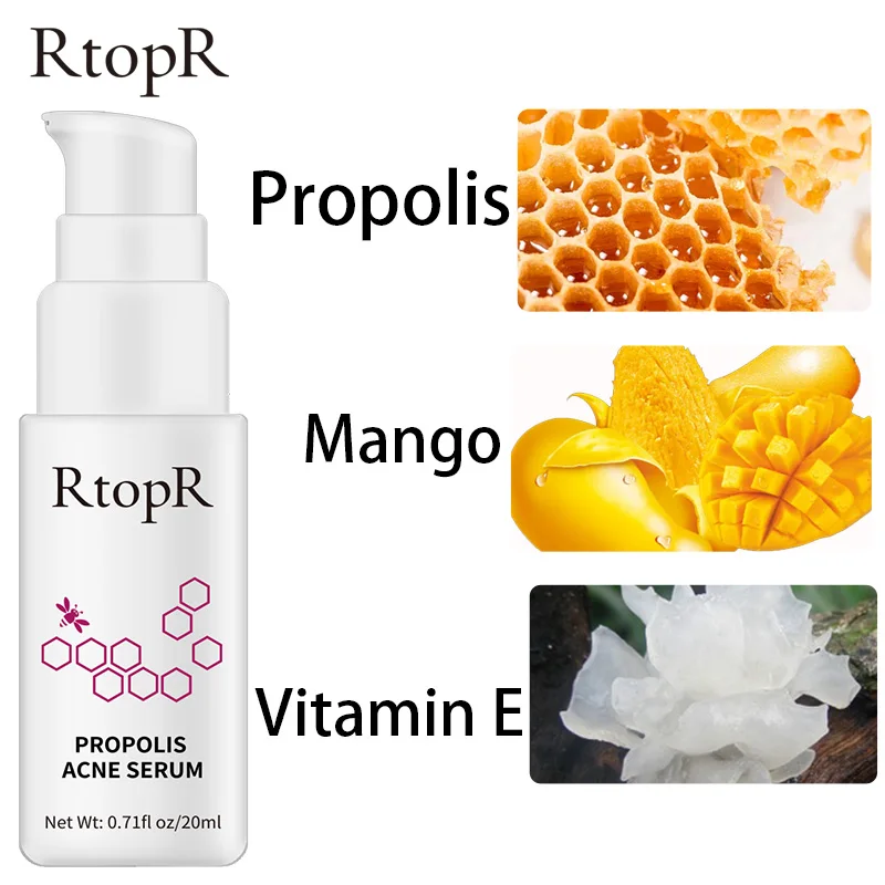 RtopR Propolis Repair Acne Brightening Serum Acne Scar Spots Cleaning Serum Shrink Pores Eliminates Acne Treatment Oil control