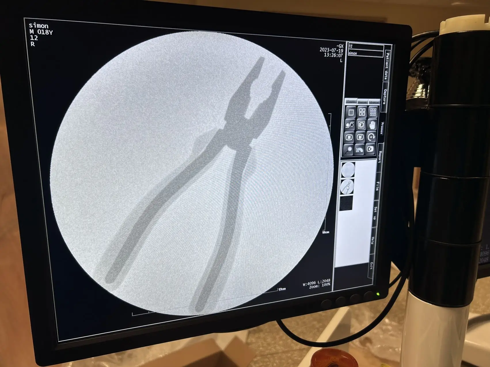 Perlove Medical With Power Sellers   PLX7000A Surgical C Arm With High	-power Generator Manufacturer