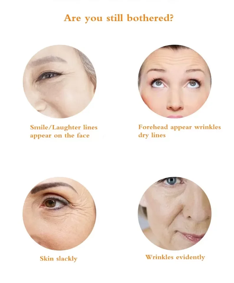 BINGJU набор эссенций с золотым коллагеном и резьбой Золотая протеиновая нить для подтяжки линия уход за лицом укрепляющая подтягивающая сыворотка