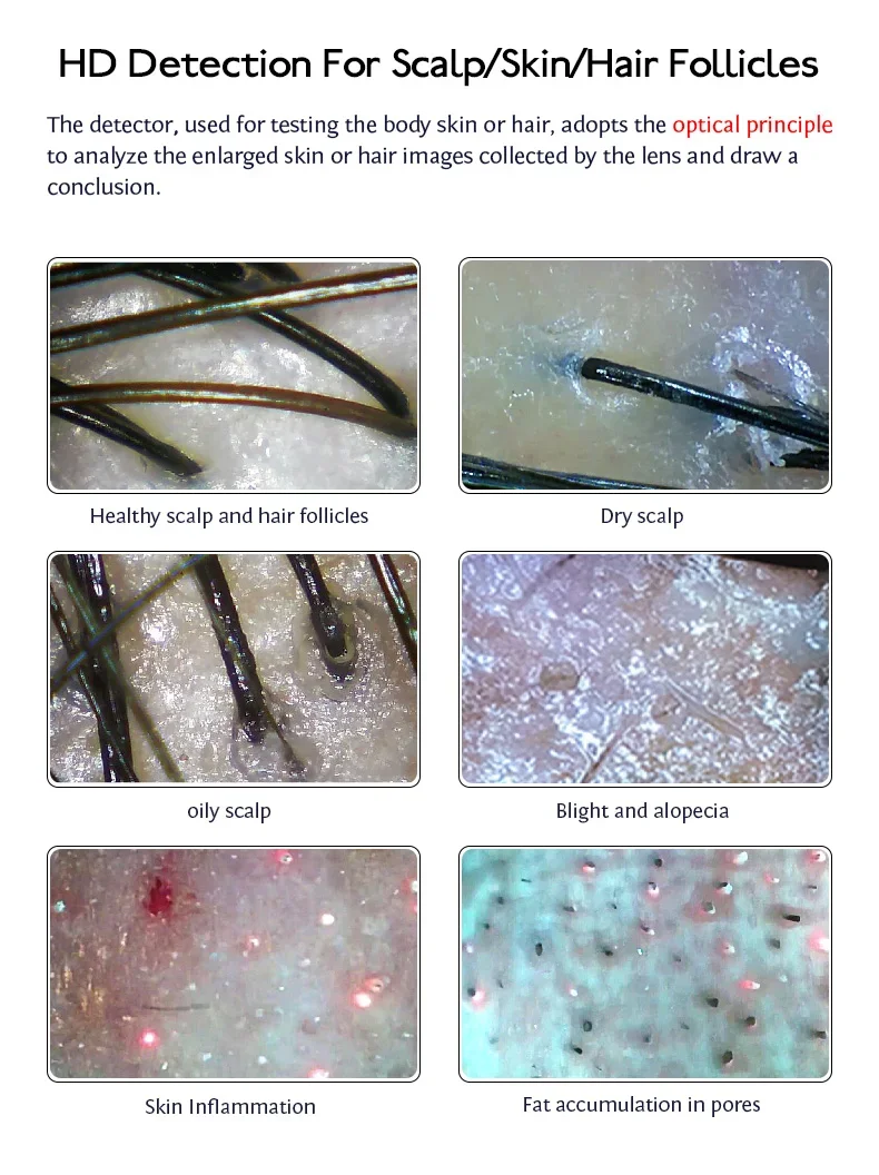 Micro Scalp Camera And Hair Analyzer Scalp Detector Wifi Microscope Smart Hair Scalp Analysis Machine