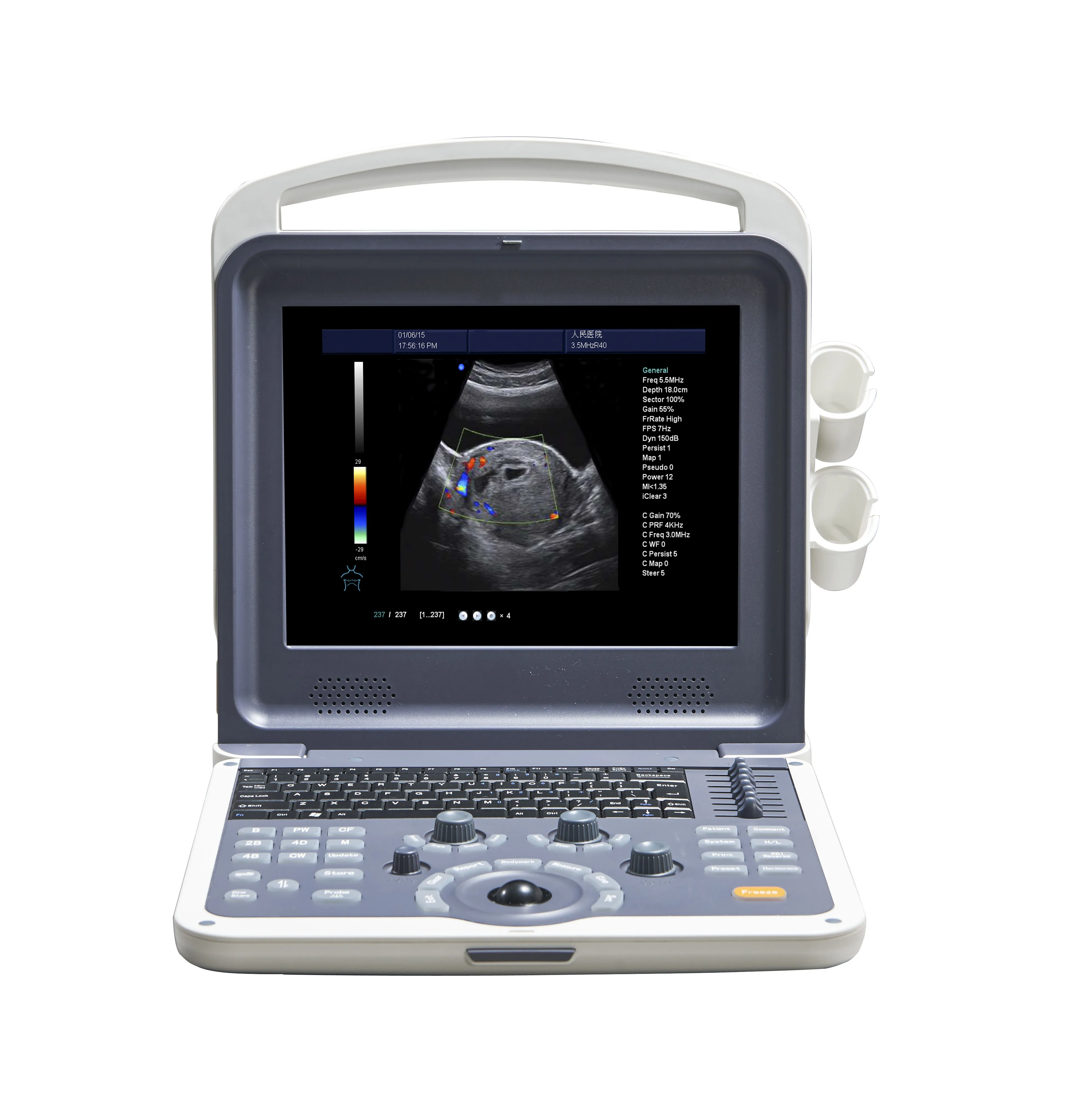 3d/4d color doppler ultrasound system medical ultrasound instruments ultrasound machine