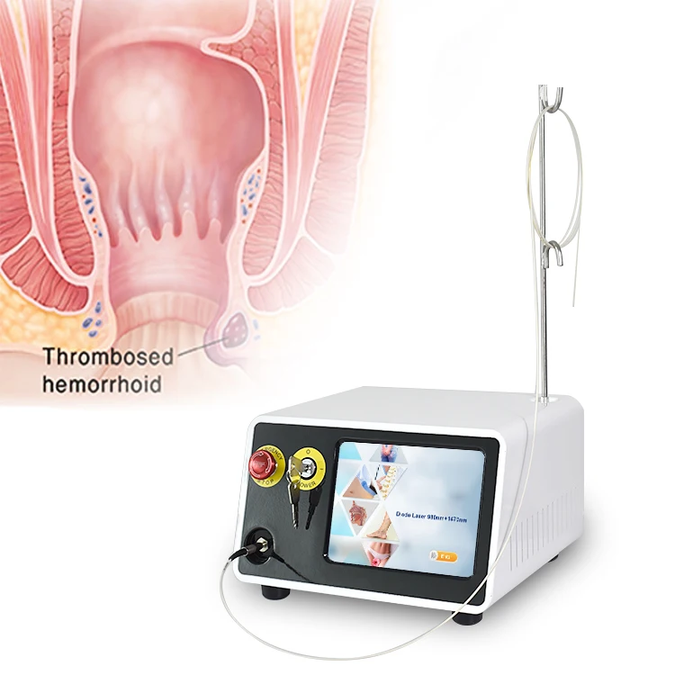 Dual wave 980nm 1470nm diode laser treatment hemorrhoid and hemorrhoid cutting