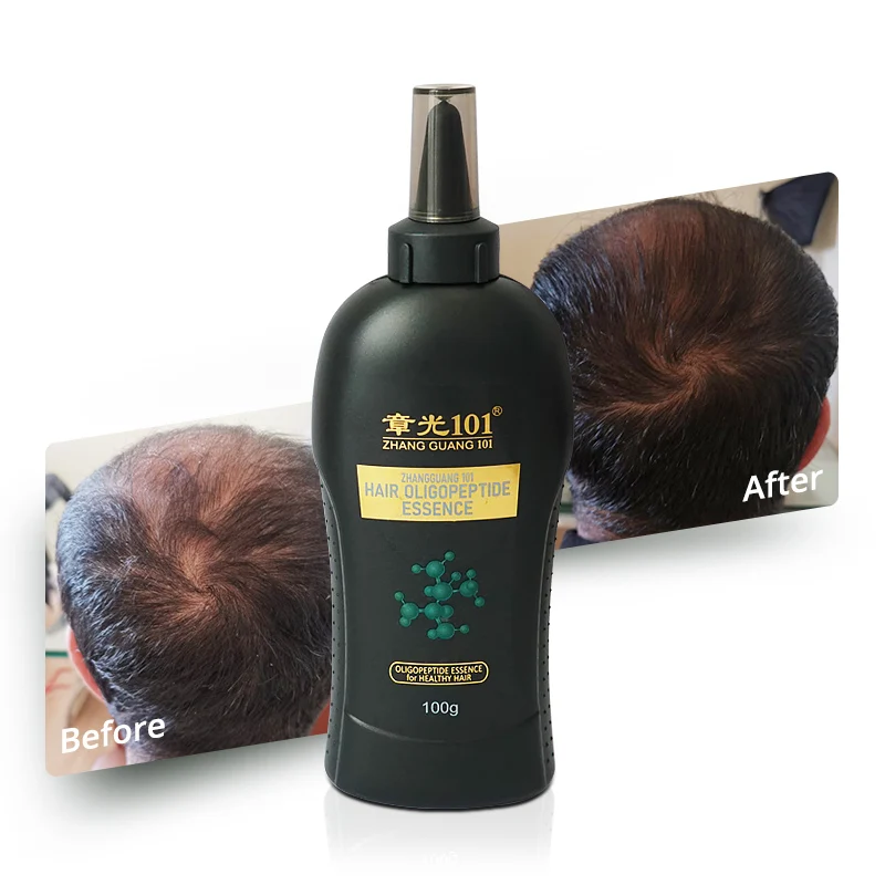 High Qiality Oligopeptide Organic Nourishing Scalp Fast Hair Growth Oil