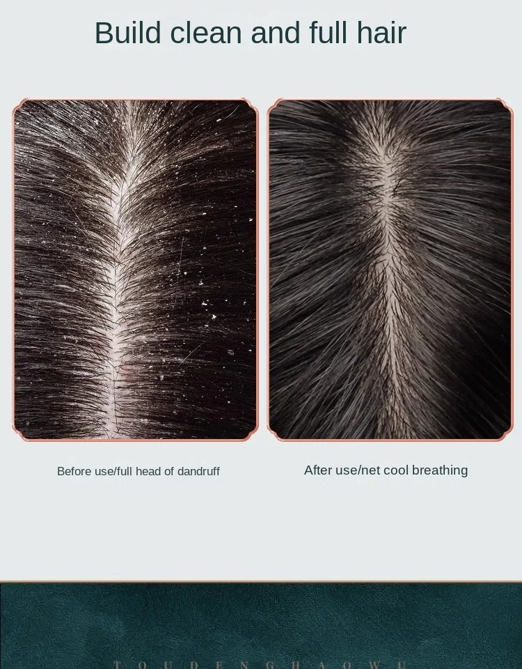 Professional Salon Red Pomegranate Anti-Dandruff Shampoo Refreshing Scalp Fluff Hair Immediately Effective