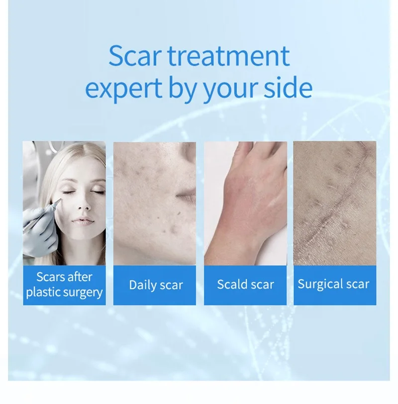 New Arrive 30g Organic Herbal Repair Gel New Old Scars Skin Face Body Scar Removal Gel Ointment