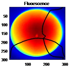 VPSSL DPSSL laser rust removal 100w laser module