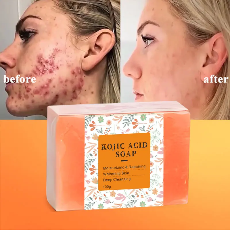 Facial Cleaning Beauty Bath Handmade Private Label Kojic Savon Skin Whitening Kojic Acid Soap