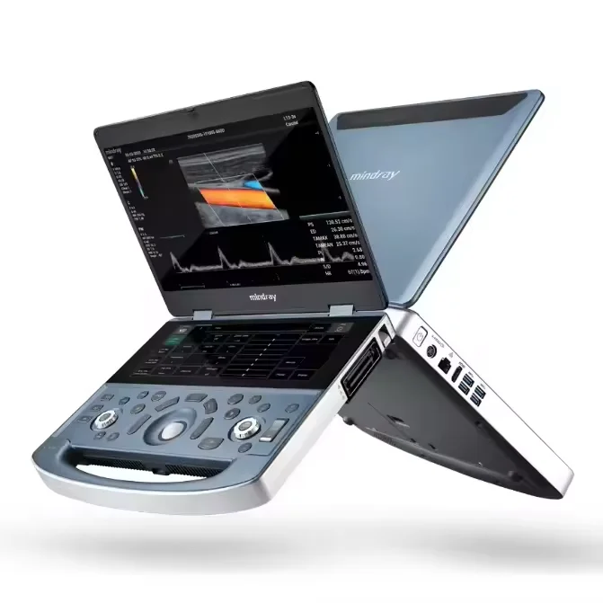 Mindray  MX7 Color Doppler Ultrasound