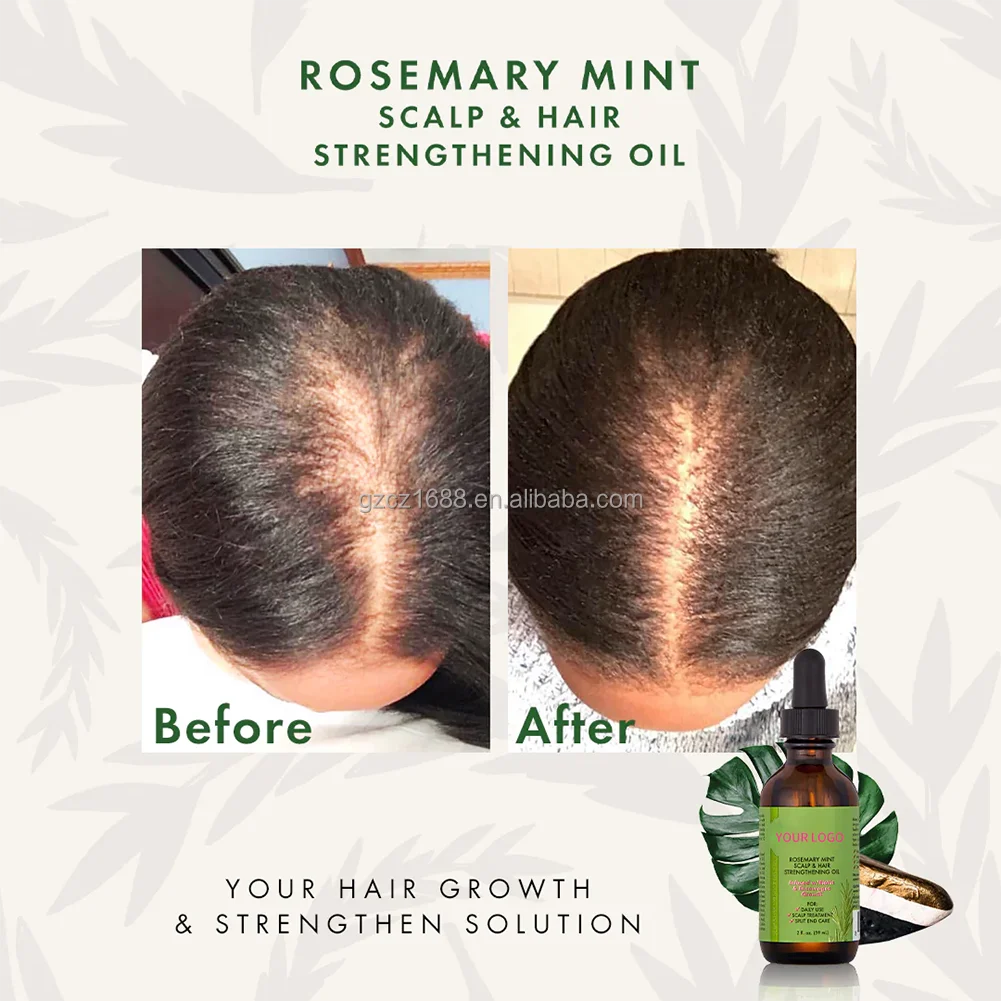 Amazon Best Selling Natural Organic Hairloss Hair Growth Serum Rosemary Oil Hair Growth Products