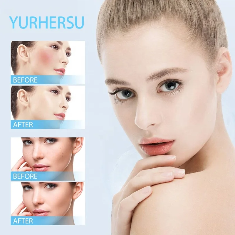 Dark Spots Corrector Remover Private Label Removal Serum Lightening Face Freckle Melasma Remover Serum Dark Spot Corrector