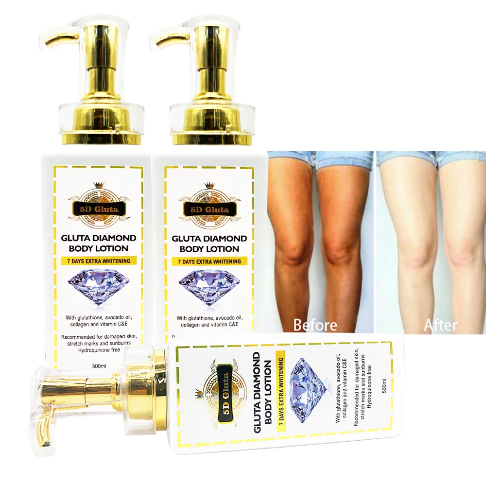5D. Алмаз Gluta. Лосьон для тела 7 дней дополнительного отбеливания рекомендуется поврежденных кожи растяжек от