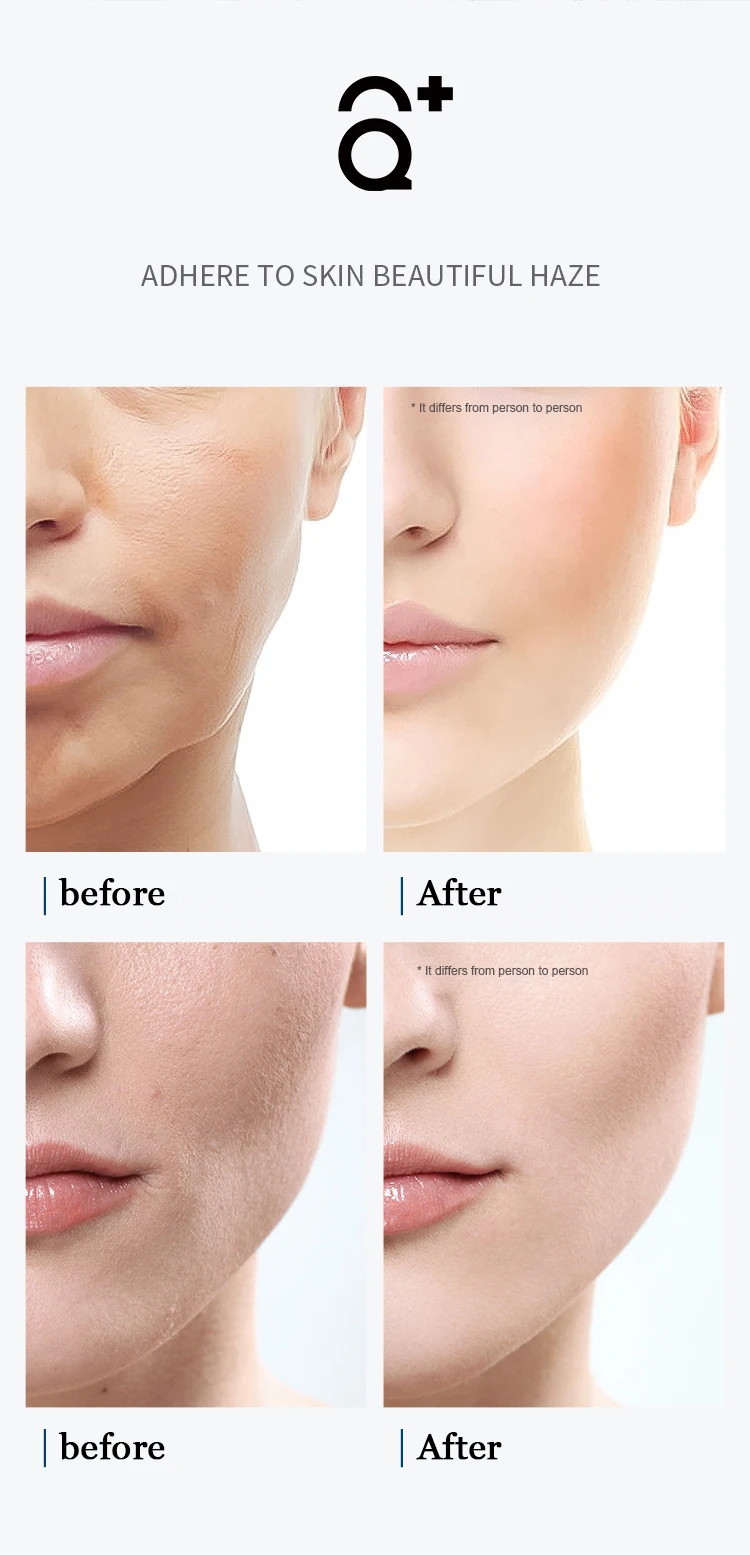 AQUA PLUS High Quality facial Cosmetics mesotherapy Hyaluronic Acid  For Face Care Facial serum