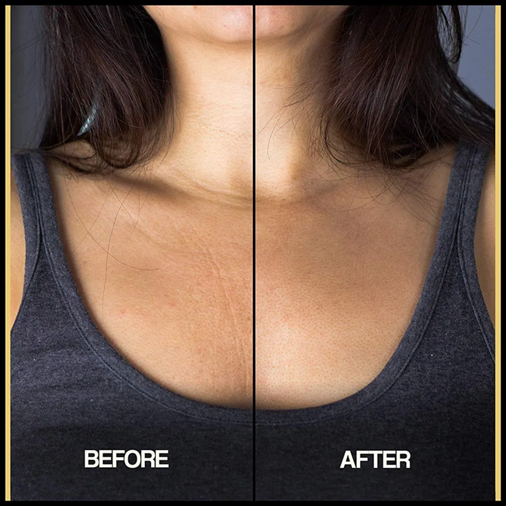 Фирменная Силиконовая накладка на грудь против морщин