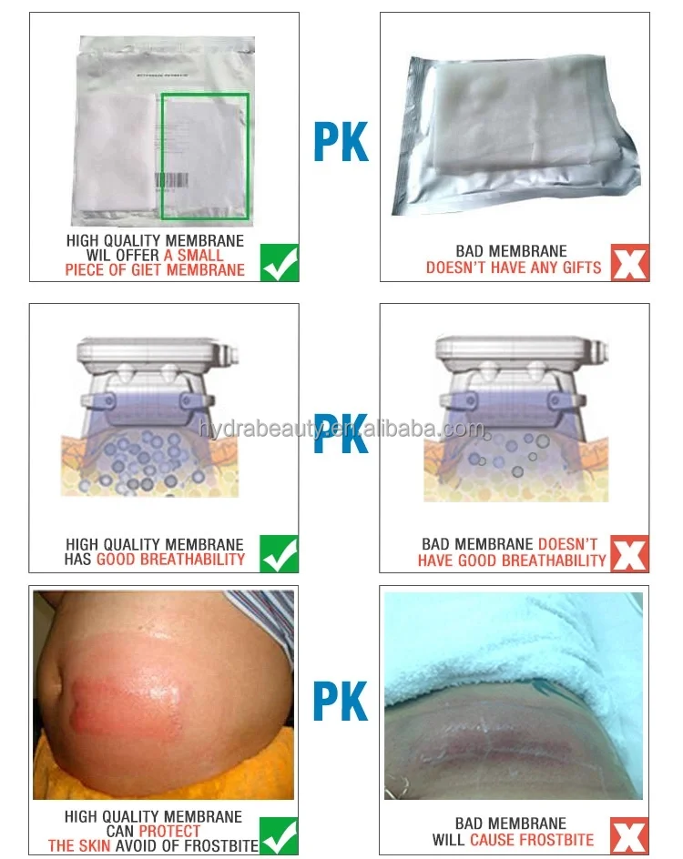 New Product Cellulite Removal Fat Freeze Equipment Cryotherapy