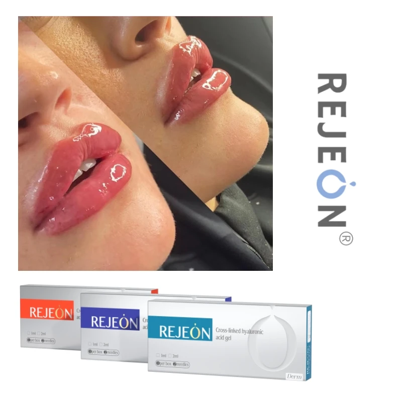 REJEON Hyluran Lip Poly Lactic Acid Dermal Filler Products Gel Ice Pack For Lip Filler After Care,