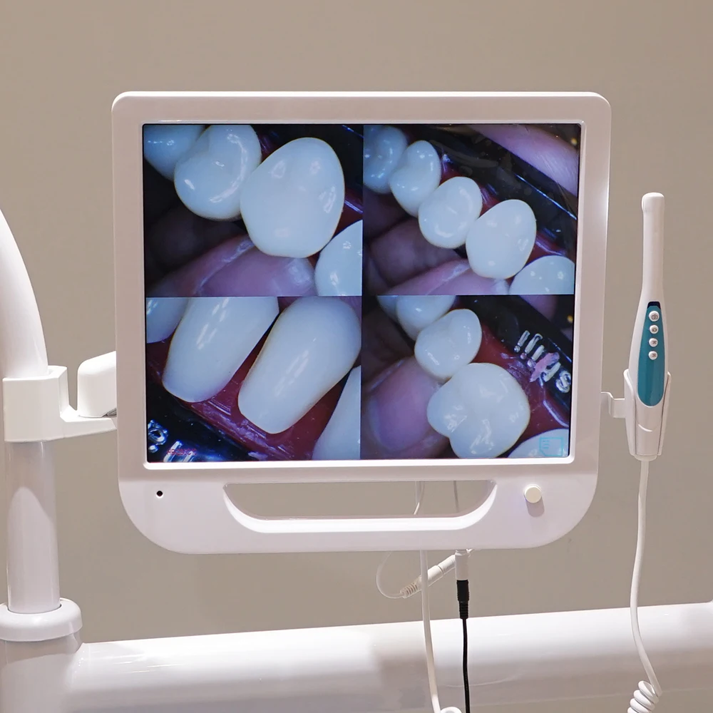 AliGan Dental equipment intra oral endoscope with 1280 x 1024 pixels 17-inch display 6 LED light beads 1/4 CMOS Image Sensor