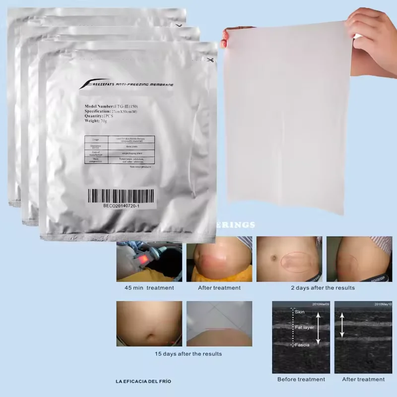 High Quality 3 Sizes Antifreeze Membrane For Cryolipolyse Slimming Cryolipolysis Antifreeze Membrane