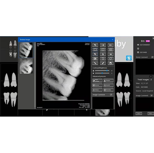 Digital X-ray Sensor Intraoral Dental Xray sensor for sale