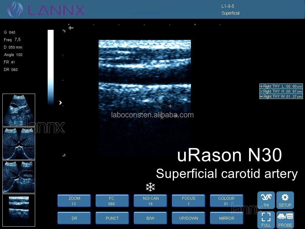 LANNX uRason N30 Hospital and Clinic Use Full Digital Portable Ultrasound Device Machine without Probe Baby Ultrasonic Scanner