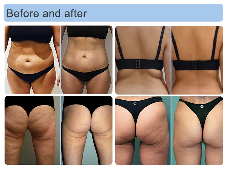 8D Vacuum Roller Cellulite Body Massager Slimming Fat Burner Endosfera Machine Cellulite Cheap Price