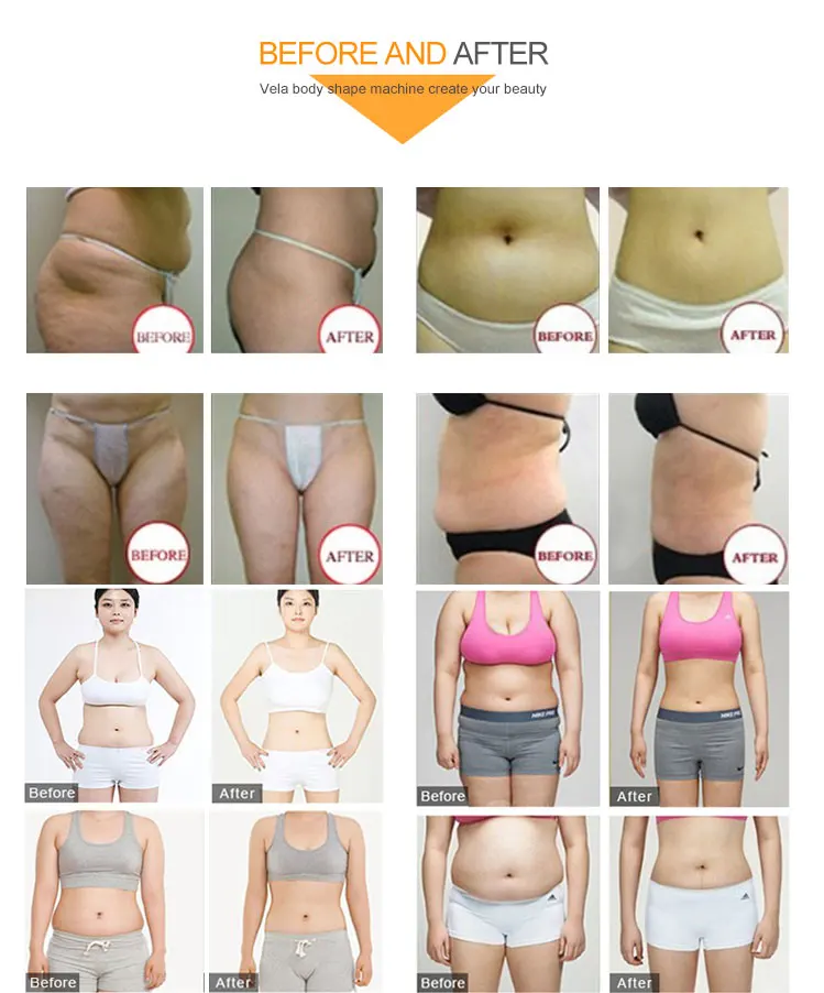 New Technology 5 In 1 Cavitation Beauty Machine RF Roller Infared Ray Vacuum Roller Equipment