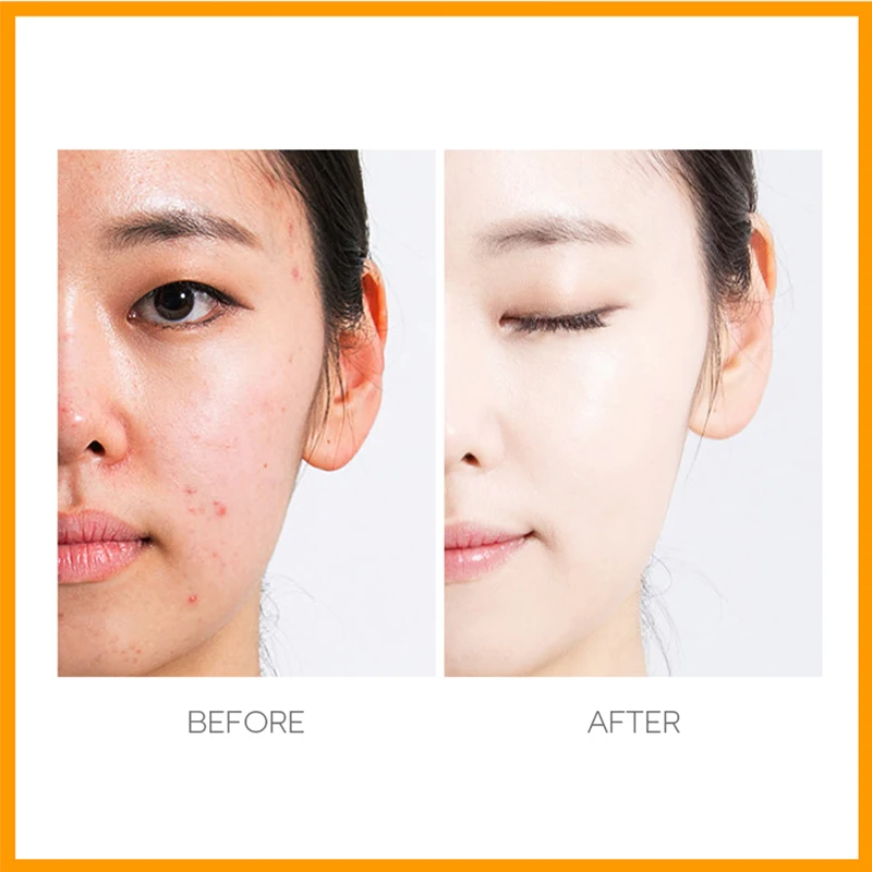 Face papaya Cream Skin Whitening Lightening pawpaw Cream Female Night Cream
