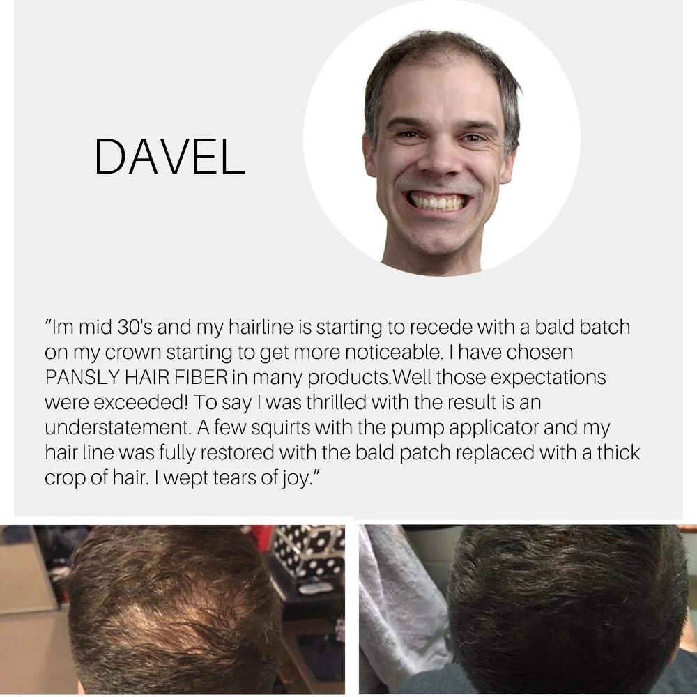 Hair Building Fiber Natural Styling Powder Loss Bald Fibre Pack Building Hairline Optimizer Dense Hair Natural Thicken