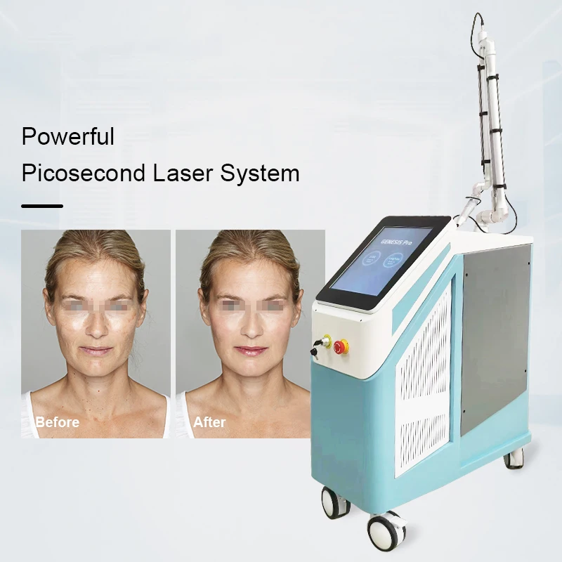 DMG manufacturer laser picoseconde professional high quality portable picosecond laser