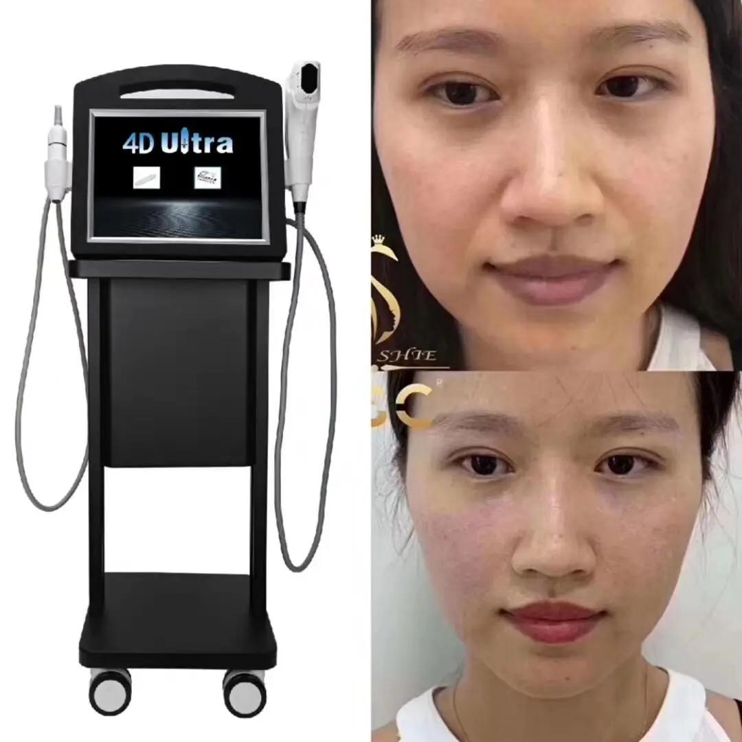 4D hi-fu smas + vmax  Anti wrinkle skin tightening  face lift wrinkle removal machine