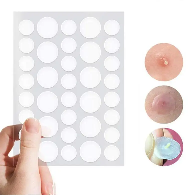 Hydrocolloid Spot Dots Treatment Acne Remover Patches Acne Pimple Healing Patch