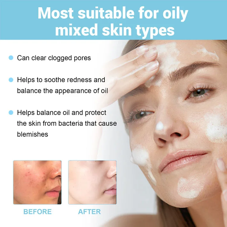 Wholesale Private Label Deep Clean Anti-Acne Gentle Remove Oily face wash facial cleanser for All Skin