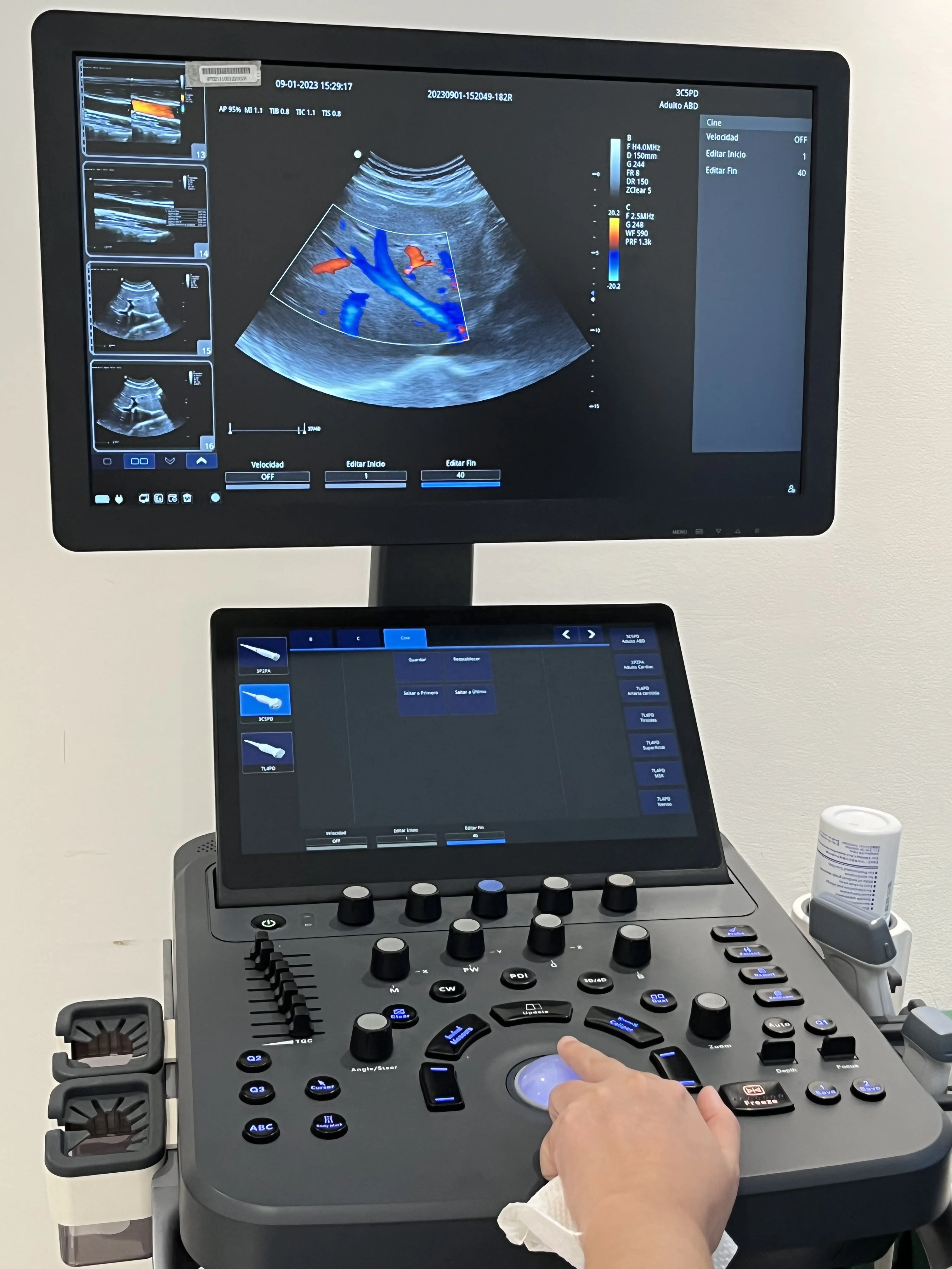 LTUB72 Medical Instruments 3D/4D Usg Machine 19 Inch Lcd Monitor Trolley Color Doppler Ultrasound