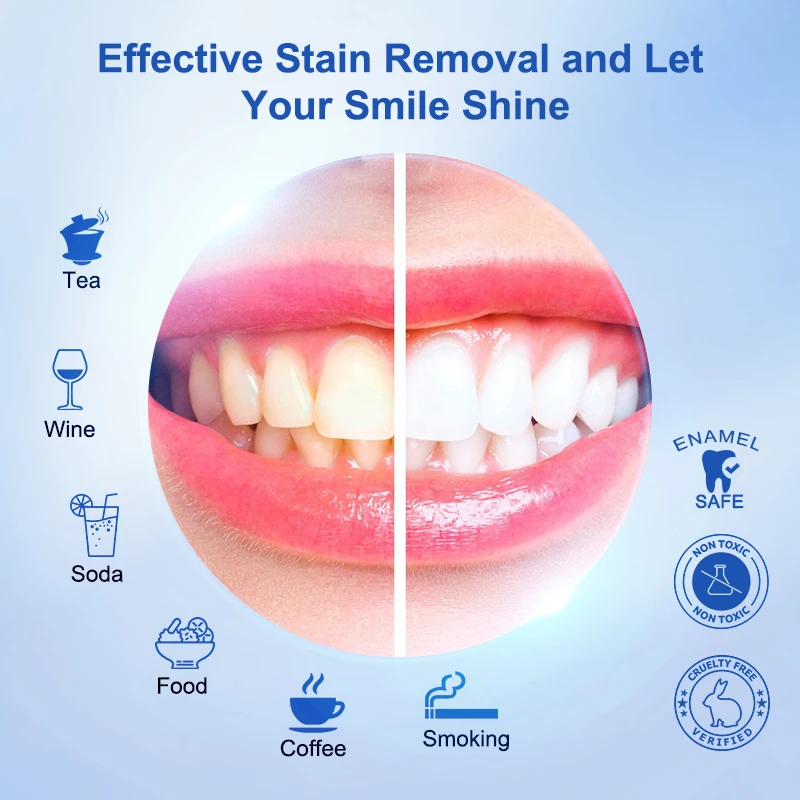 Custom Bright 21 Treatments 6% Hp Peroxide Free Flavored Wholesale Pap Dissolving Tooth Dental Whiting Teeth 5d Whitening Strips